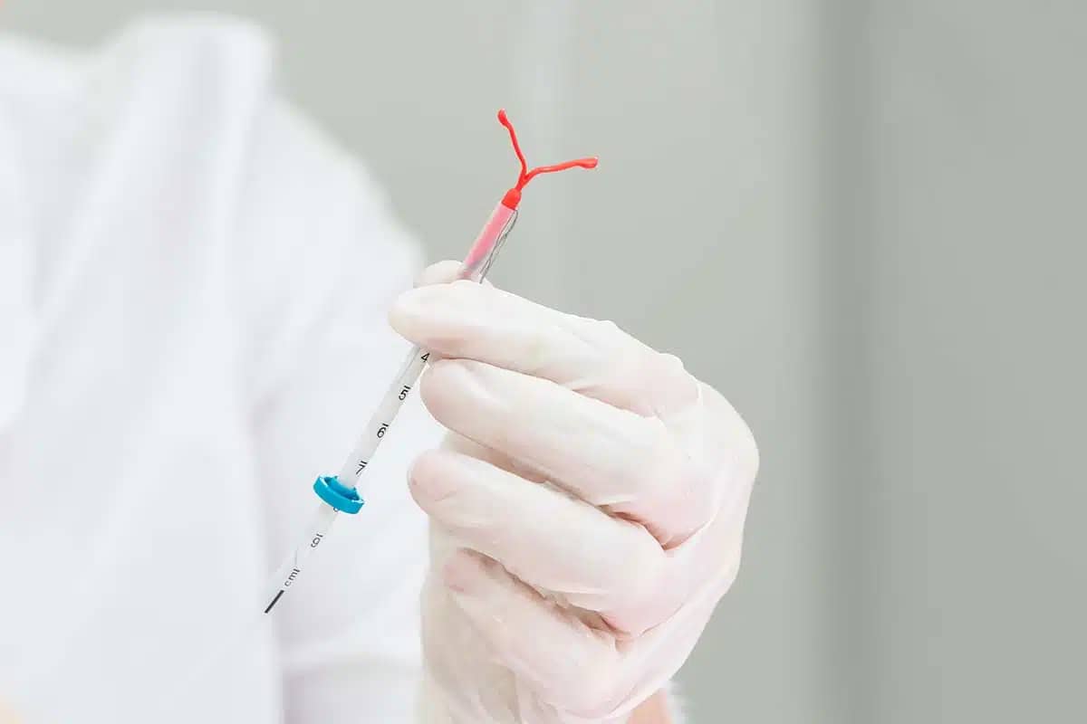 iud-hormonspirale-foto-1